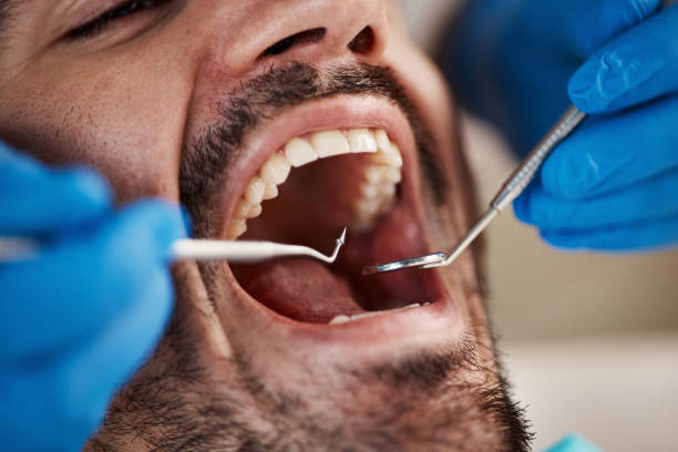 Best Cracked Tooth Emergency Dentist  in Newport, OH