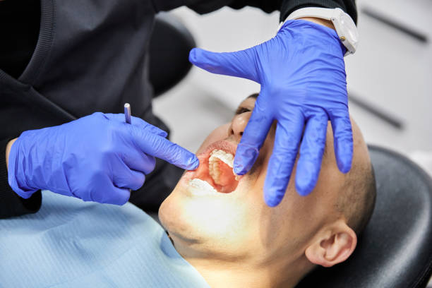Dentist for Dental Trauma in OH