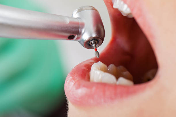 Best Urgent Tooth Repair  in Newport, OH